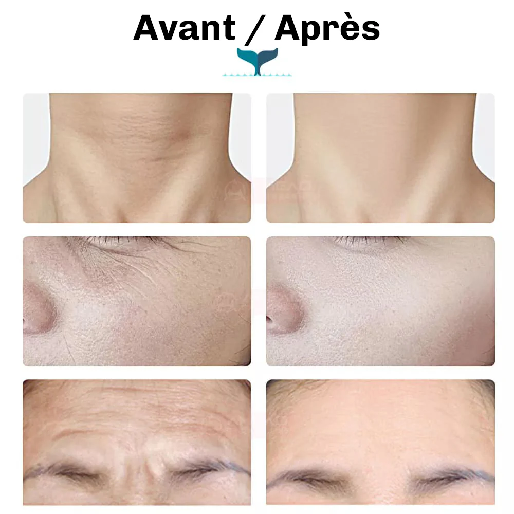 LumiFace Appareil de Soin Visage - Image 4