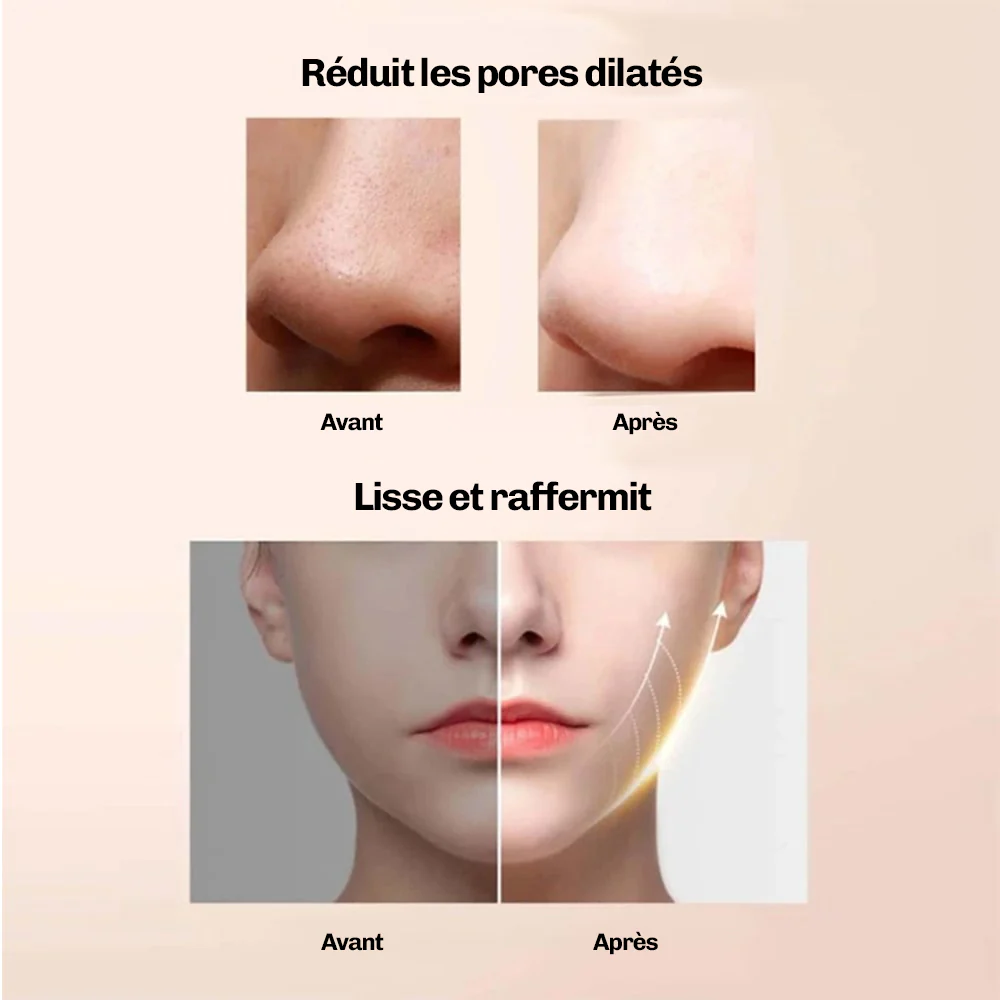 DermaGlow 5 - Ultrasons Peeling Visage - Image 10