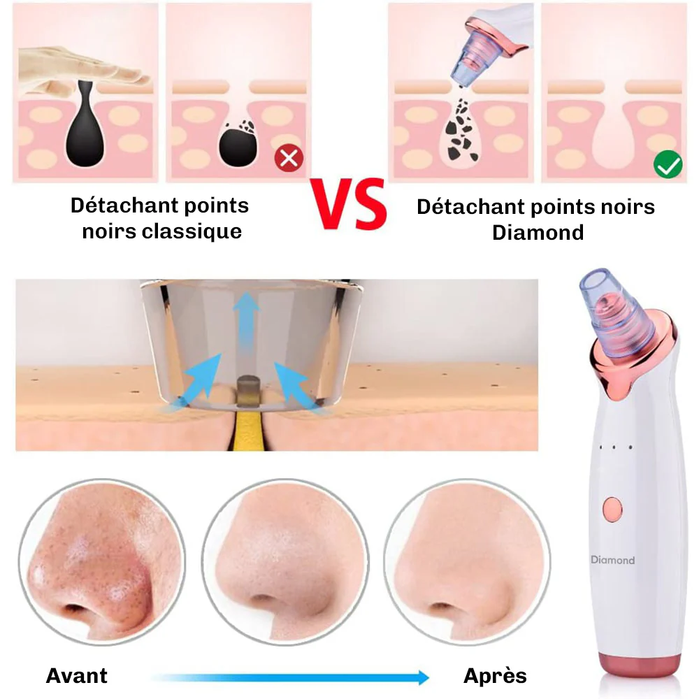 SkinClear 3 Aspirateur à Points Noirs - Image 10